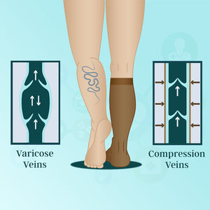 Medtex Class-1 Cotton compression stockings for varicose veins,Knee length,Thigh Length