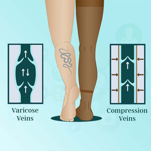 Medtex anti-embolism stockings for DVT prevention, TED stockings in skin color