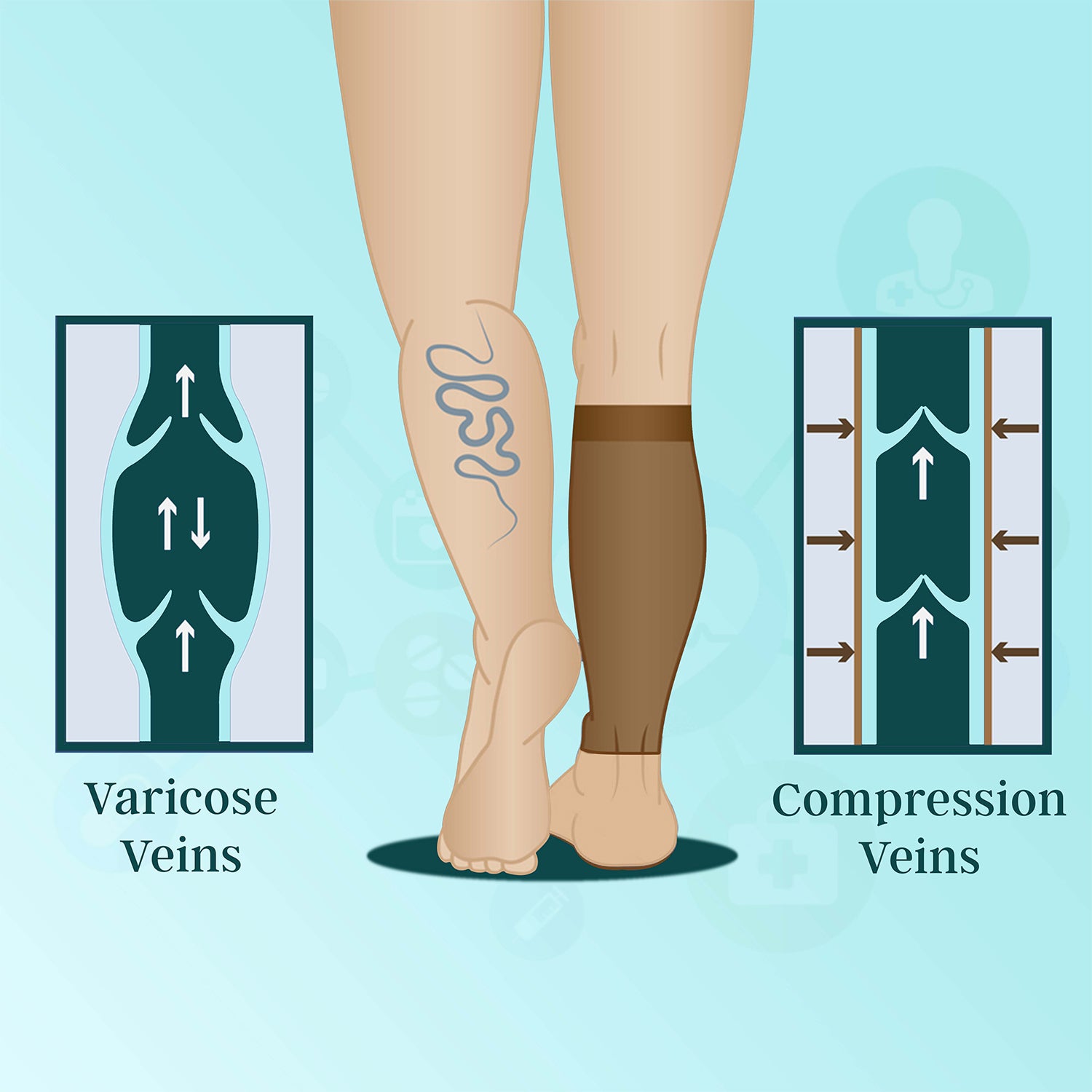 Medtex calf compression sleeve for muscle support, beige color