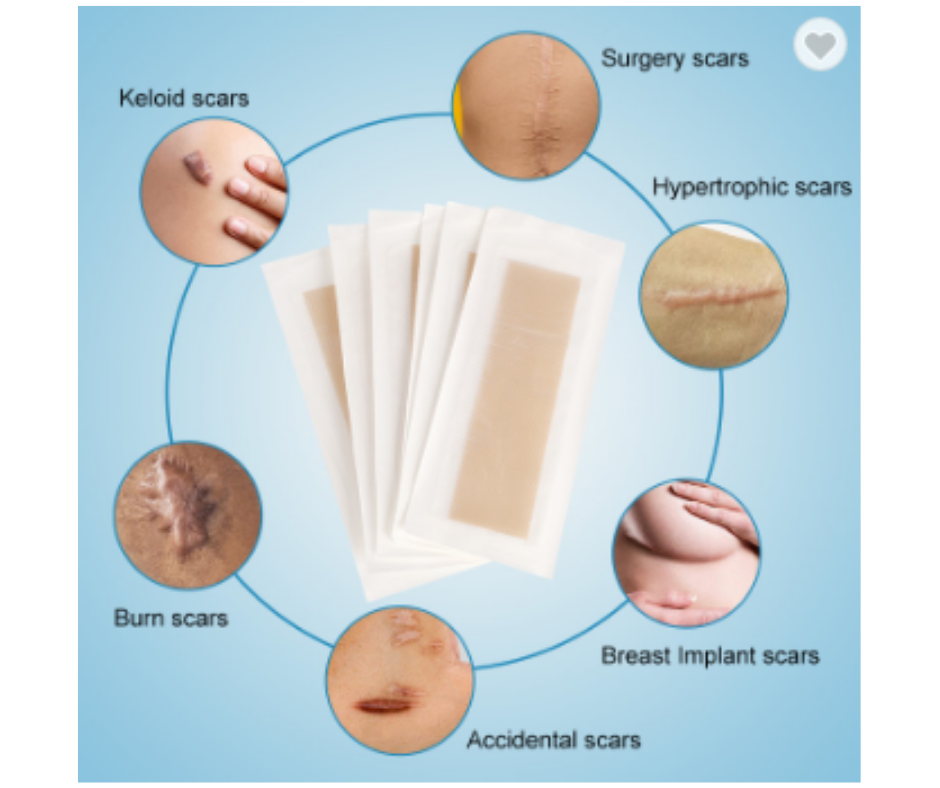 Medtex silicone gel sheet for scar treatment and keloid managementSilicone Gel Sheet, Scar Gel sheet for Keloid scars