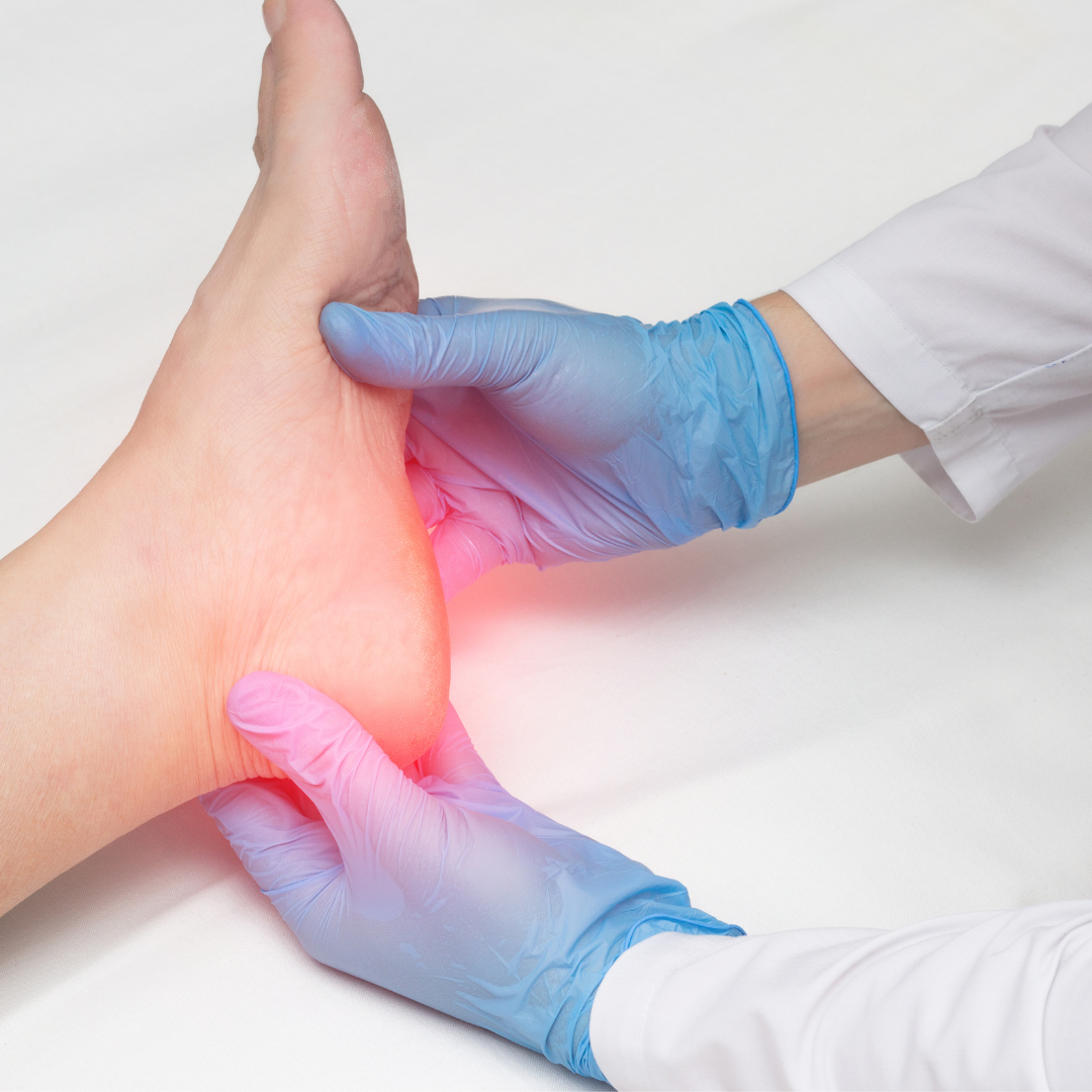 "Ankle Compression for Swelling and Sprain: Effective Support and Relief"