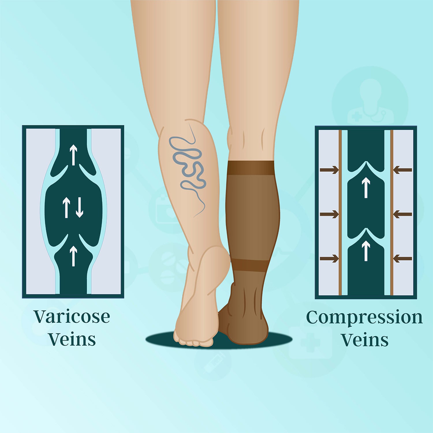 Medtex anti-embolism stockings for DVT prevention, TED stockings in skin color