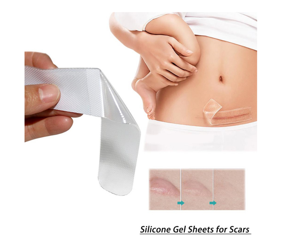 Medtex silicone gel sheet for scar treatment and keloid management​Silicone Gel Sheet, Scar Gel sheet for Keloid scars